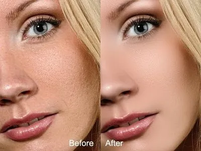 SkinFiner 5.7.2 (x64)